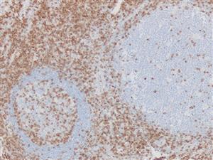 3770B | Control Slides:Immunopathology; CD3, T-Cell
